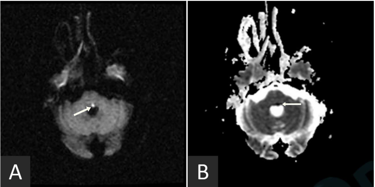 Figure 1.JPG